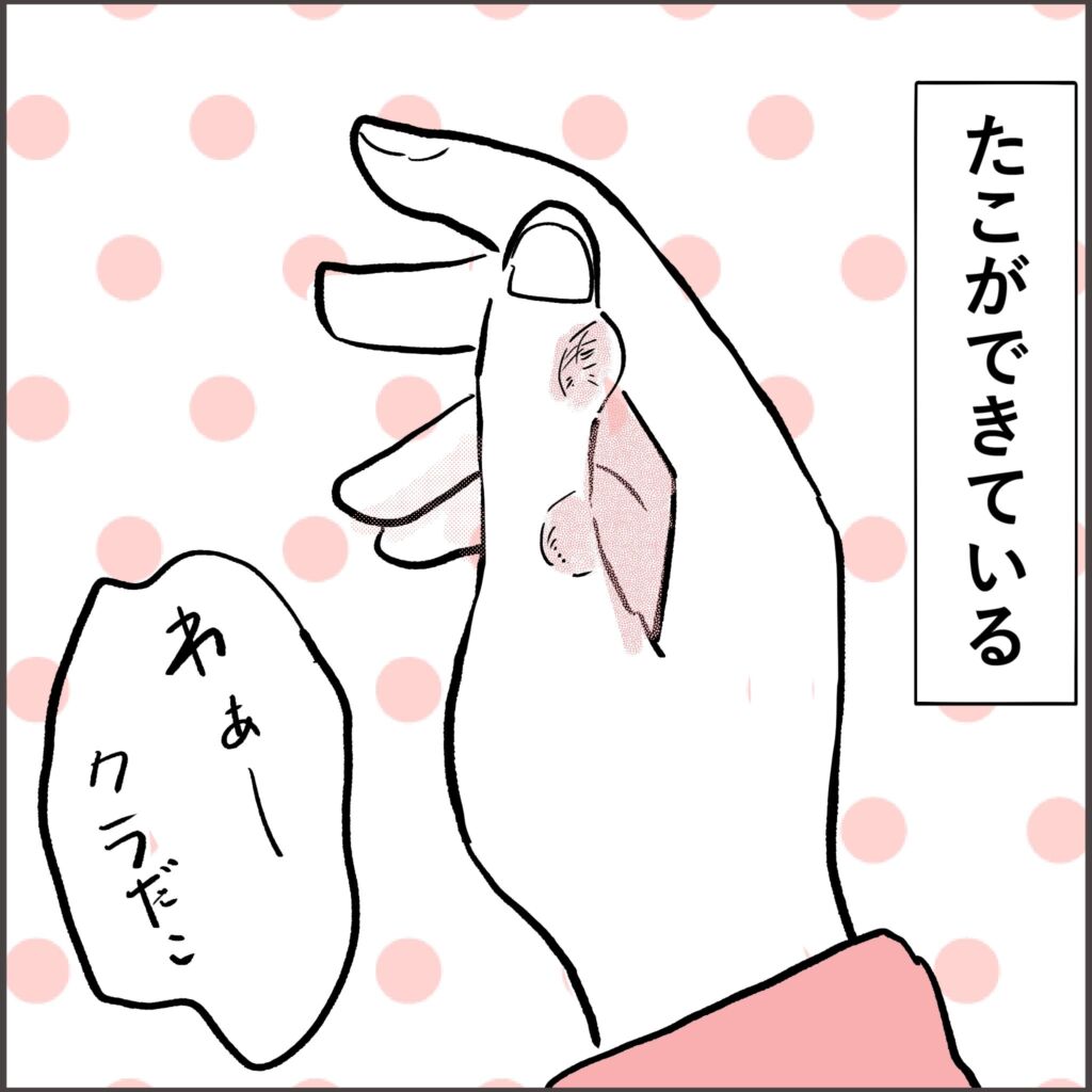 クラリネット奏者の右親指にたこができている漫画「たこができている」「わぁークラだこ」
